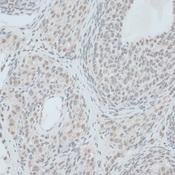 ZNF416 Antibody - Immunohistochemistry of paraffin-embedded Rat ovary using ZNF416 Polyclonal Antibody at dilution of 1:100 (40x lens).