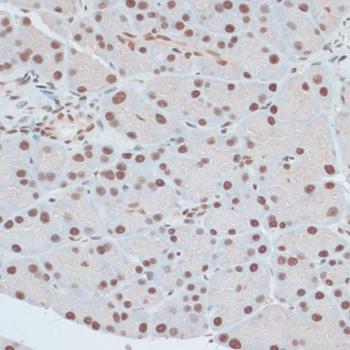 ZNF416 Antibody - Immunohistochemistry of paraffin-embedded Rat pancreas using ZNF416 Polyclonal Antibody at dilution of 1:100 (40x lens).