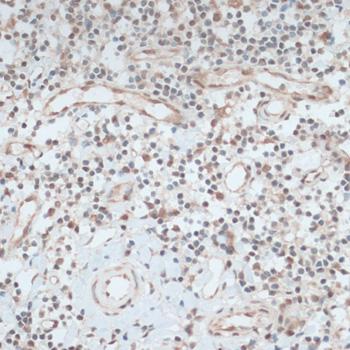 ZNF416 Antibody - Immunohistochemistry of paraffin-embedded Human tonsil using ZNF416 Polyclonal Antibody at dilution of 1:100 (40x lens).
