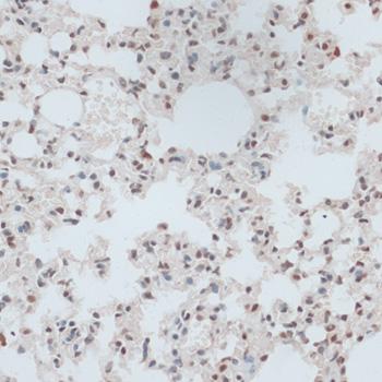 ZNF416 Antibody - Immunohistochemistry of paraffin-embedded Mouse lung using ZNF416 Polyclonal Antibody at dilution of 1:100 (40x lens).