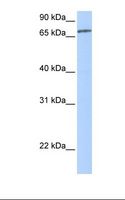 ZNF418 Antibody - MCF7 cell lysate. Antibody concentration: 1.0 ug/ml. Gel concentration: 12%.  This image was taken for the unconjugated form of this product. Other forms have not been tested.