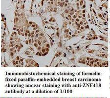 ZNF418 Antibody