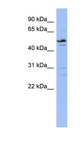 ZNF419 Antibody - ZNF419 antibody Western blot of HT1080 cell lysate. This image was taken for the unconjugated form of this product. Other forms have not been tested.