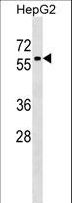 ZNF419 Antibody - ZNF419 Antibody western blot of HepG2 cell line lysates (35 ug/lane). The ZNF419 antibody detected the ZNF419 protein (arrow).