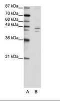 ZNF419 Antibody - A: Marker, B: HepG2 Cell Lysate.  This image was taken for the unconjugated form of this product. Other forms have not been tested.