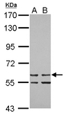 ZNF419 Antibody - Sample (30 ug of whole cell lysate) A: 293T B: A431 7.5% SDS PAGE ZNF419 antibody diluted at 1:1000