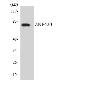 ZNF420 Antibody - Western blot analysis of the lysates from COLO205 cells using ZNF420 antibody.