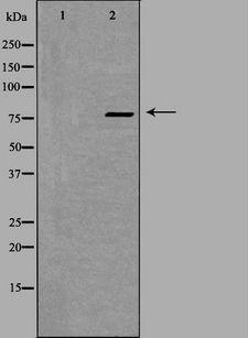 ZNF420 Antibody - Western blot analysis of extracts of K562 cells using ZNF420 antibody. The lane on the left is treated with the antigen-specific peptide.
