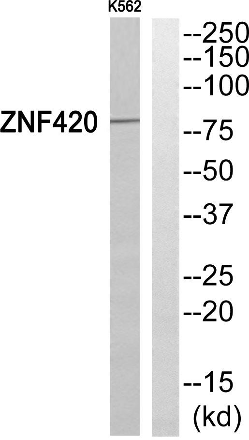 ZNF420 Antibody - Western blot analysis of extracts from K562 cells, using ZNF420 antibody.