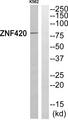 ZNF420 Antibody - Western blot analysis of extracts from K562 cells, using ZNF420 antibody.