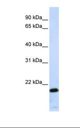 ZNF428 Antibody - Jurkat cell lysate. Antibody concentration: 1.0 ug/ml. Gel concentration: 12%.  This image was taken for the unconjugated form of this product. Other forms have not been tested.