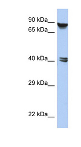 ZNF429 Antibody - ZNF429 antibody Western blot of HepG2 cell lysate. This image was taken for the unconjugated form of this product. Other forms have not been tested.