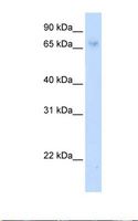 ZNF432 Antibody - Transfected 293T cell lysate. Antibody concentration: 1.0 ug/ml. Gel concentration: 12%.  This image was taken for the unconjugated form of this product. Other forms have not been tested.
