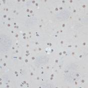 ZNF433 Antibody - Immunohistochemistry of paraffin-embedded Rat brain using ZNF433 Polyclonal Antibody at dilution of 1:100 (40x lens).