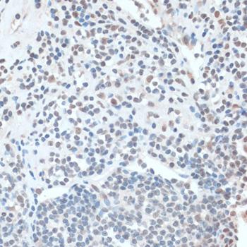 ZNF433 Antibody - Immunohistochemistry of paraffin-embedded Human appendix using ZNF433 Polyclonal Antibody at dilution of 1:100 (40x lens).