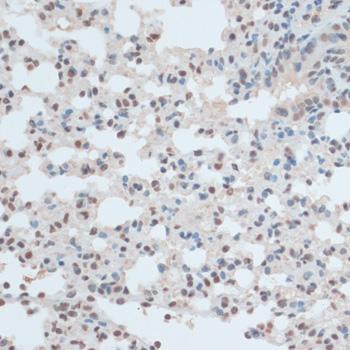 ZNF433 Antibody - Immunohistochemistry of paraffin-embedded Mouse lung using ZNF433 Polyclonal Antibody at dilution of 1:100 (40x lens).