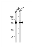 ZNF434 Antibody - ZNF434 Antibody western blot of Jurkat,MCF-7 cell line lysates (35 ug/lane). The ZNF434 antibody detected the ZNF434 protein (arrow).