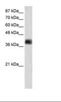 ZNF435 / ZSCAN16 Antibody - Transfected 293T Cell Lysate.  This image was taken for the unconjugated form of this product. Other forms have not been tested.