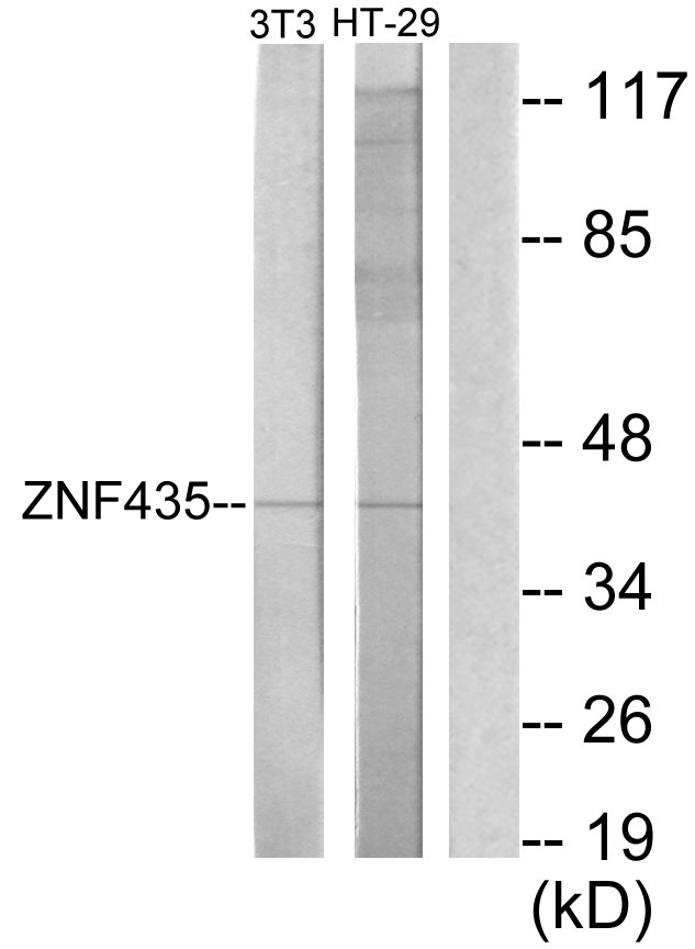 ZNF435 / ZSCAN16 Antibody - Western blot analysis of lysates from NIH/3T3 and HT-29 cells, using ZNF435 Antibody. The lane on the right is blocked with the synthesized peptide.