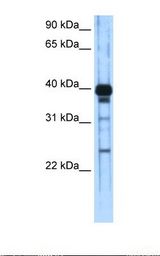 ZNF435 / ZSCAN16 Antibody - Transfected 293T cell lysate. Antibody concentration: 1.0 ug/ml. Gel concentration: 12%.  This image was taken for the unconjugated form of this product. Other forms have not been tested.
