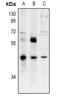 ZNF435 / ZSCAN16 Antibody - Western blot analysis of ZNF392 expression in HCT116 (A), DLD (B), mouse brain (C) whole cell lysates.