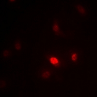 ZNF435 / ZSCAN16 Antibody - Immunofluorescent analysis of ZNF392 staining in HeLa cells. Formalin-fixed cells were permeabilized with 0.1% Triton X-100 in TBS for 5-10 minutes and blocked with 3% BSA-PBS for 30 minutes at room temperature. Cells were probed with the primary antibody in 3% BSA-PBS and incubated overnight at 4 °C in a hidified chamber. Cells were washed with PBST and incubated with Alexa Fluor 647-conjugated secondary antibody (red) in PBS at room temperature in the dark.