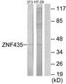 ZNF435 / ZSCAN16 Antibody - Western blot analysis of extracts from NIH-3T3 cells and HT-29 cells, using ZNF435 antibody.