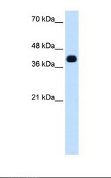 ZNF435 / ZSCAN16 Antibody - Transfected 293T cell lysate. Antibody concentration: 0.625 ug/ml. Gel concentration: 12%.  This image was taken for the unconjugated form of this product. Other forms have not been tested.