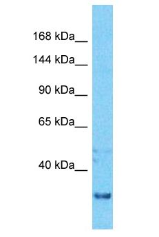 ZNF436 Antibody - ZNF436 antibody Western Blot of ACHN. Antibody dilution: 1 ug/ml.  This image was taken for the unconjugated form of this product. Other forms have not been tested.