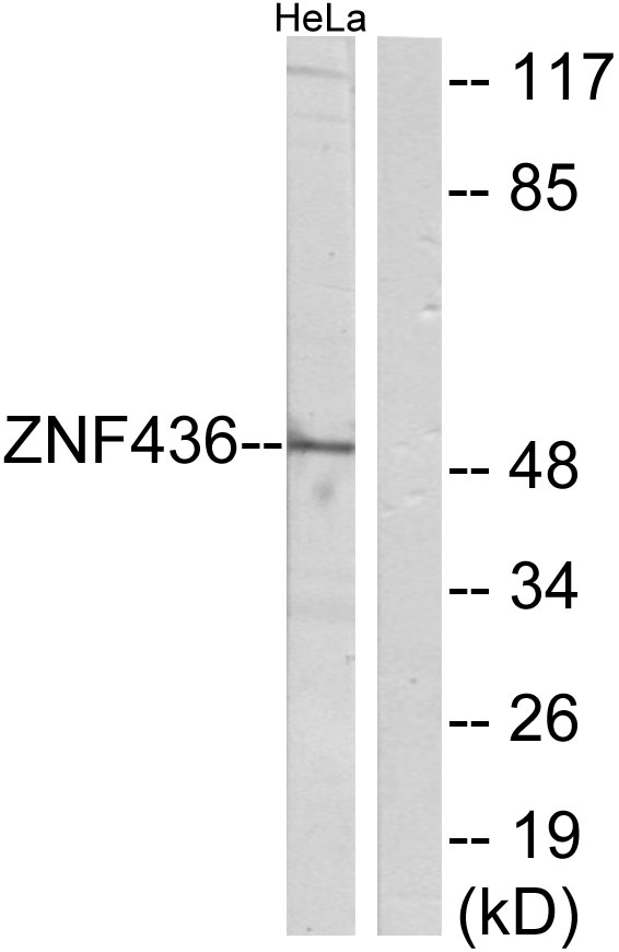 ZNF436 Antibody - Western blot analysis of lysates from HeLa cells, using ZNF436 Antibody. The lane on the right is blocked with the synthesized peptide.