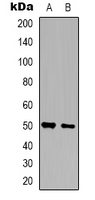 ZNF436 Antibody - Western blot analysis of ZNF436 expression in HepG2 (A); U251 (B) whole cell lysates.