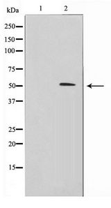 ZNF436 Antibody - Western blot of HeLa cell lysate using ZNF436 Antibody