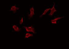 ZNF436 Antibody - Staining HeLa cells by IF/ICC. The samples were fixed with PFA and permeabilized in 0.1% Triton X-100, then blocked in 10% serum for 45 min at 25°C. The primary antibody was diluted at 1:200 and incubated with the sample for 1 hour at 37°C. An Alexa Fluor 594 conjugated goat anti-rabbit IgG (H+L) Ab, diluted at 1/600, was used as the secondary antibody.