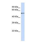 ZNF44 / GIOT-2 Antibody - Western blot of Human MCF7. ZNF44 antibody dilution 1.0 ug/ml.  This image was taken for the unconjugated form of this product. Other forms have not been tested.