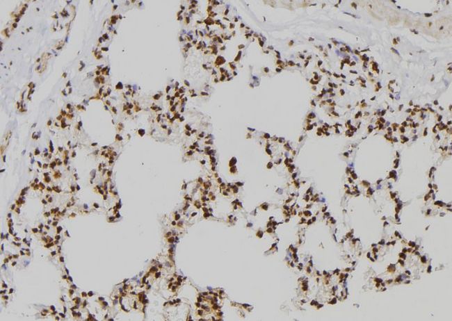 ZNF440 Antibody - 1:100 staining rat lung tissue by IHC-P. The sample was formaldehyde fixed and a heat mediated antigen retrieval step in citrate buffer was performed. The sample was then blocked and incubated with the antibody for 1.5 hours at 22°C. An HRP conjugated goat anti-rabbit antibody was used as the secondary.