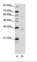 ZNF440 Antibody - A: Marker, B: HepG2 Cell Lysate.  This image was taken for the unconjugated form of this product. Other forms have not been tested.