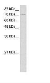 ZNF441 Antibody - Jurkat Cell Lysate.  This image was taken for the unconjugated form of this product. Other forms have not been tested.