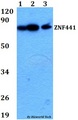ZNF441 Antibody - Western blot of ZNF441 antibody at 1:500 dilution. Lane 1: HEK293T whole cell lysate. Lane 2: A549 whole cell lysate. Lane 3: PC12 whole cell lysate.