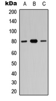 ZNF441 Antibody - Western blot analysis of ZNF441 expression in HEK293T (A); A549 (B); PC12 (C) whole cell lysates.