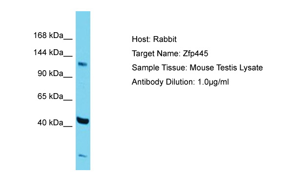 ZNF445 Antibody -  This image was taken for the unconjugated form of this product. Other forms have not been tested.
