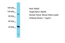 ZNF445 Antibody -  This image was taken for the unconjugated form of this product. Other forms have not been tested.
