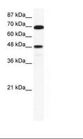 ZNF446 Antibody - Jurkat Cell Lysate.  This image was taken for the unconjugated form of this product. Other forms have not been tested.
