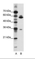 ZNF446 Antibody - A: Marker, B: HepG2 Cell Lysate.  This image was taken for the unconjugated form of this product. Other forms have not been tested.