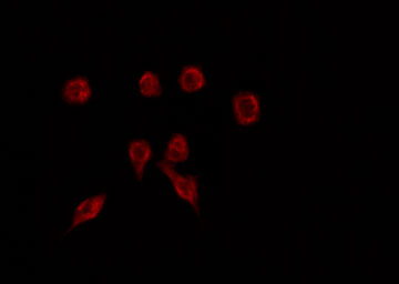 ZNF446 Antibody - Staining HuvEc cells by IF/ICC. The samples were fixed with PFA and permeabilized in 0.1% Triton X-100, then blocked in 10% serum for 45 min at 25°C. The primary antibody was diluted at 1:200 and incubated with the sample for 1 hour at 37°C. An Alexa Fluor 594 conjugated goat anti-rabbit IgG (H+L) Ab, diluted at 1/600, was used as the secondary antibody.