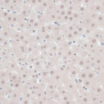 ZNF446 Antibody - Immunohistochemistry of paraffin-embedded Rat liver using ZNF446 Polyclonal Antibody at dilution of 1:100 (40x lens).