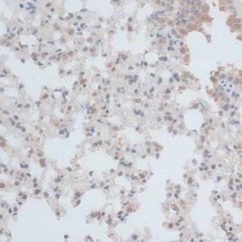 ZNF446 Antibody - Immunohistochemistry of paraffin-embedded Mouse lung using ZNF446 Polyclonal Antibody at dilution of 1:100 (40x lens).