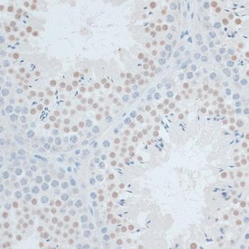 ZNF446 Antibody - Immunohistochemistry of paraffin-embedded Mouse testis using ZNF446 Polyclonal Antibody at dilution of 1:100 (40x lens).