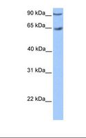 ZNF449 Antibody - Transfected 293T cell lysate. Antibody concentration: 1.0 ug/ml. Gel concentration: 12%.  This image was taken for the unconjugated form of this product. Other forms have not been tested.