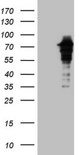 ZNF449 Antibody - HEK293T cells were transfected with the pCMV6-ENTRY control. (Left lane) or pCMV6-ENTRY ZNF449. (Right lane) cDNA for 48 hrs and lysed. Equivalent amounts of cell lysates. (5 ug per lane) were separated by SDS-PAGE and immunoblotted with anti-ZNF449. (1:2000)