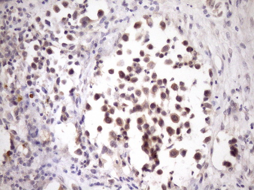 ZNF449 Antibody - Immunohistochemical staining of paraffin-embedded Human bladder tissue within the normal limits using anti-ZNF449 mouse monoclonal antibody. (Heat-induced epitope retrieval by Tris-EDTA, pH8.0)(1:150)